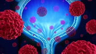 La biopsia líquida permitirá anticipar qué pacientes con cáncer de vejiga necesitarán inmunoterapia tras la cirugía y cuáles pueden evitarla