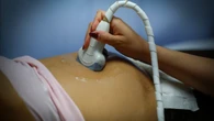Qué es la “decepción de género” durante el embarazo: el duelo silencioso de madres que esperaban una hija y tendrán un hijo