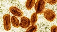 Sanidad recomienda a los grupos de riesgo que se pongan la vacuna preexposición ante la mpox