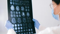 Estas son las bebidas que están consideradas como "oro para el cerebro": una reduce el riesgo de demencia