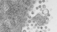 Un estudio identifica una proteína "central" en el Covid persistente y halla diferencias de sexo