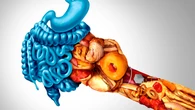 La Enfermedad de Crohn, una patología inflamatoria intestinal crónica que afecta a cada vez más jóvenes