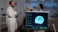 Un parche de seda hecho en España podría ayudar al cerebro a recuperarse tras un ictus