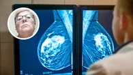 Una paciente denuncia los retrasos del cribado de cáncer de mama: "Si me lo hubieran pillado antes, no habría perdido todo el pecho"
