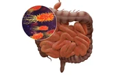 Identifican una huella de mayor riesgo tumoral detectable en el microbioma