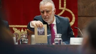 "Caso mascarillas": El ministro Torres relega al "pasado" la causa que acecha a su exalto cargo