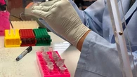 ¿Existe vacuna para el hantavirus?