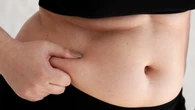 Vinculan un tipo de grasa visceral con el cáncer de endometrio agresivo