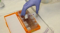 Médicos españoles investigan un fármaco a partir del cannabis para el daño cerebral en recién nacidos