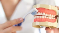 Dientes amarillos: causas reales y mitos que necesitas conocer