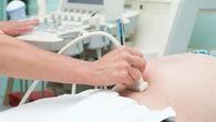 Esta es la lista de países que tienen el derecho al aborto incluido en su Constitución
