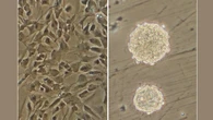 Identifican una nueva diana para tratar el glioblastoma con inmunoterapia