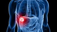 Una investigadora española logra un prometedor avance en cáncer de hígado
