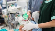 Qué pasa en el cerebro cuando te ponen anestesia general: un estado distinto al sueño y al coma