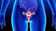 Día Mundial del Cáncer de Ovario: Qué son los anticuerpos conjugados dirigidos y qué otros tratamientos existen