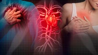 Médicos de Primaria defienden el papel clave de los betabloqueantes post-infarto, pese a los resultados recientes de un estudio internacional