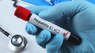 España, preparada para eliminar la hepatitis C