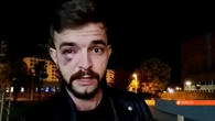 Un periodista, agredido por radicales 'abertzales' que se dirigían al evento cancelado de Vito Quiles en Navarra