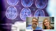 Científicos españoles en colaboración con otros países revierten el Alzheimer en ratones con nanotecnología revolucionaria