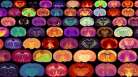 El antojo por el azúcar en la infancia tendría un motivo: el desarrollo cerebral
