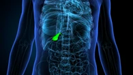 Razones para el optimismo en pacientes con colestasis