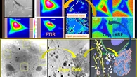 Identifican nuevos factores ambientales clave en la ELA