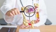 Alemania detecta también un aumento del cáncer colorrectal entre los 20 y los 39 años, pero por debajo de los niveles de Estados Unidos