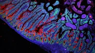 Harvard halla una pista clave en cáncer colorrectal: el intestino tiene 'memoria' y se acuerda de lo que comemos