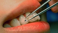 El descubrimiento que jubila a los implantes: la ciencia desvela el 'interruptor' para hacer crecer nuevos dientes