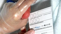 La Comunidad de Madrid amplía hasta 35 las patologías de la prueba del talón, frente a las 21 aprobadas por Sanidad este año