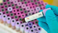 Así funciona la primera terapia para prevenir el VIH inyectable cada dos meses