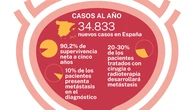 El atlas del cáncer de próstata