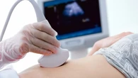 100 ginécologos avalan el 'síndrome postaborto'