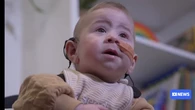 Dos gemelos con sordera escuchan a su madre por primera vez gracias a una novedosa cirugía