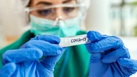 Las variasntes Stratus y Nimbus reviven el COVID en otoño: “este virus sigue entre nosotros”