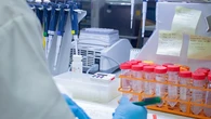 Última hora del brote de hantavirus en directo: La pasajera francesa positivo en hantavirus está en estado crítico