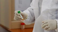 Qué es el hantavirus y cómo se contagia la enfermedad que ha afectado a los pasajeros del crucero MV Hondius