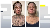 Una mujer, obligada a tatuarse 250 veces el nombre de su pareja por toda la cara y el cuerpo