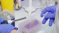 Científicos españoles descubren cómo envejece la sangre: un gran hallazgo para la lucha contra la leucemia y el envejecimiento