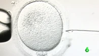 Hallan microplásticos en óvulos y esperma humanos: una señal de alerta para la fertilidad