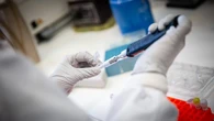 Científicos estadounidenses descubren la causa del Lupus y una posible manera de poder revertirlo