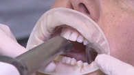 20 carillas, paseos en camello y excursiones en quads por 800 euros: así funciona el turismo dental en Marruecos