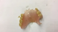 La Asociación Española de Endodoncia denuncia los peligros de la “odontología biológica” que promueve extracciones innecesarias ante el Consejo de Dentistas