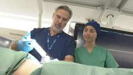 Cirujanos españoles desarrollan una técnica pionera para tratar a pacientes con cáncer peritoneal inoperable