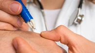 Cronobiología o cómo se optimizan tratamientos médicos según la hora del día en la que se realicen