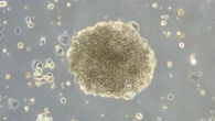Científicos del CSIC descubren una nueva vía para tratar un cáncer de hígado muy agresivo