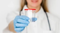 Los médicos advierten de los peligros de comprar semen por internet: kits de inseminación sin control sanitario