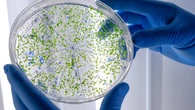 Las infecciones por bacterias multirresistentes serán la primera causa de muerte por enfermedad en 2050