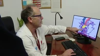 Hito en el Hospital de Bellvitge al extirpar un tipo de cáncer de páncreas considerado inoperable
