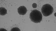 Una estrategia con luz capaz de eliminar células tumorales resistentes del cáncer de mama